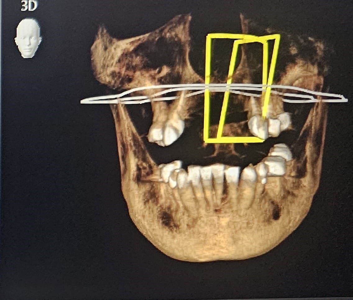 3D-Röntgen